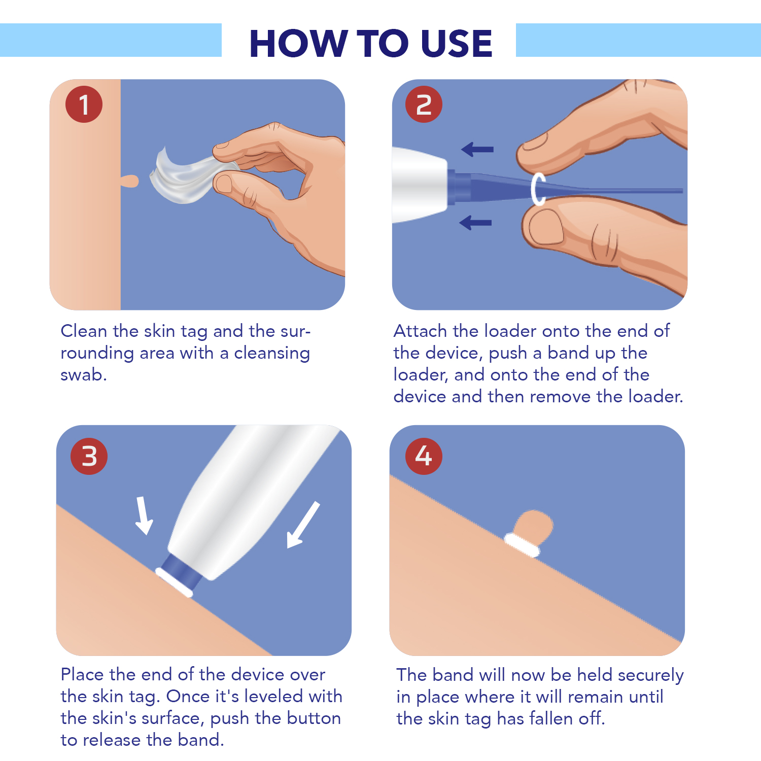 TagOff Skin Tag Removal Kit 2-IN-1 - Image 5