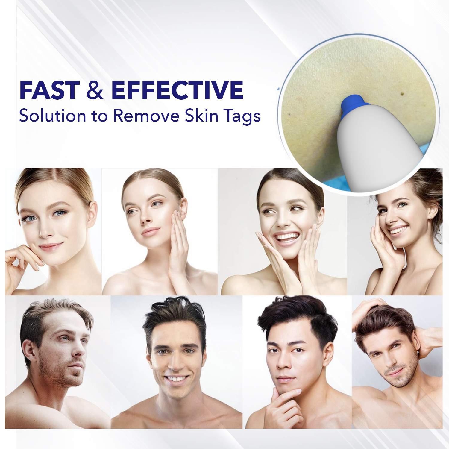 TagOff Skin Tag Removal Kit 2-IN-1 - Image 4